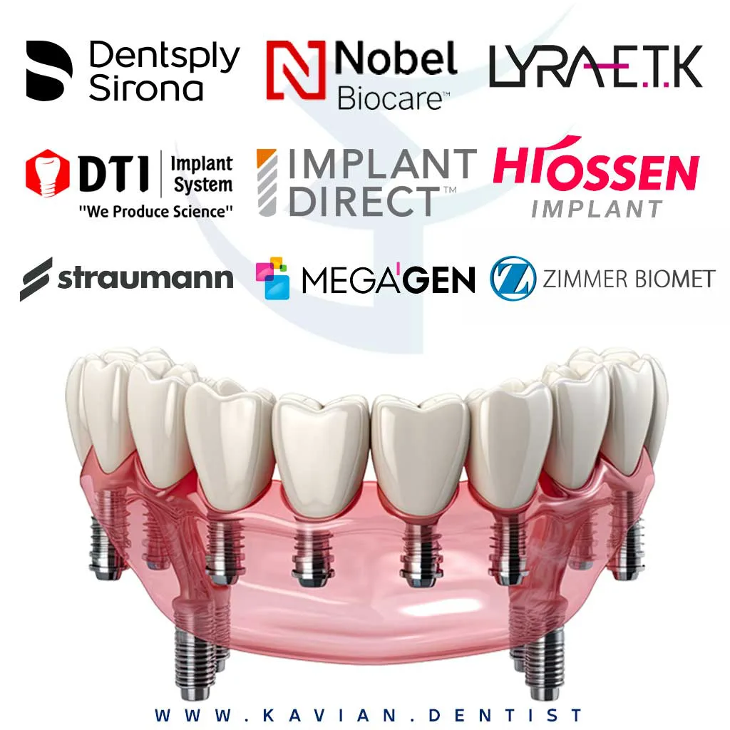 لیست برندهای معروف ایمپلنت دندان
